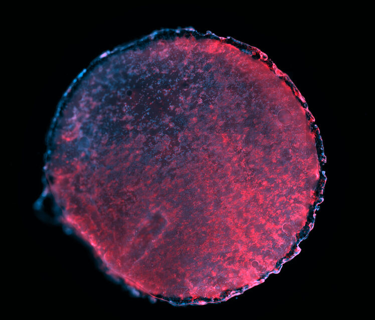 Stem-cell-patch-Richard-Tan-3000