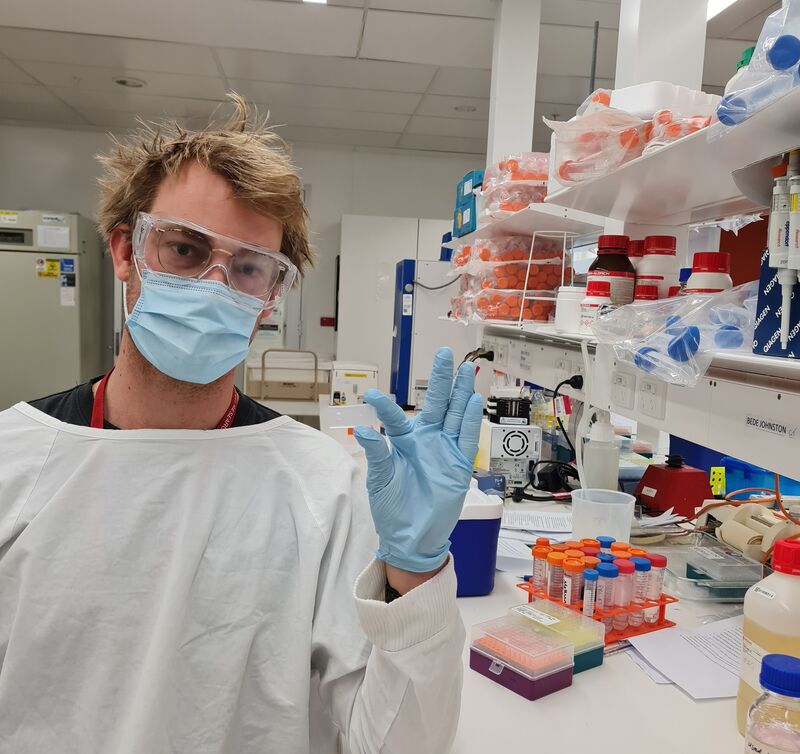 Bede Johnston holding biochip