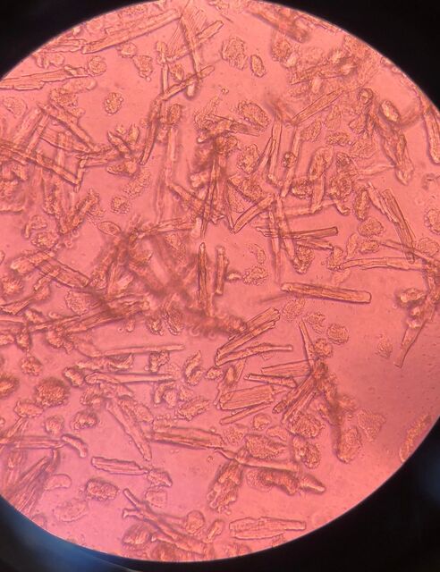 2 Cultured mouse cardiomyocytes