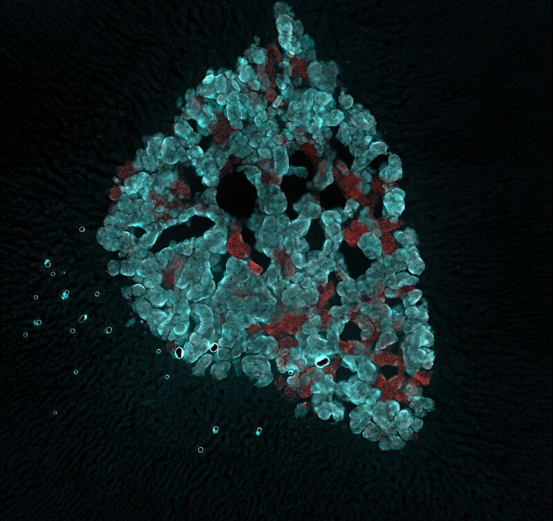 Zohra-Kakall_Adrenaline-synthesizing-neurons-activated-in-the-adrenal-gland-following-hypoxia