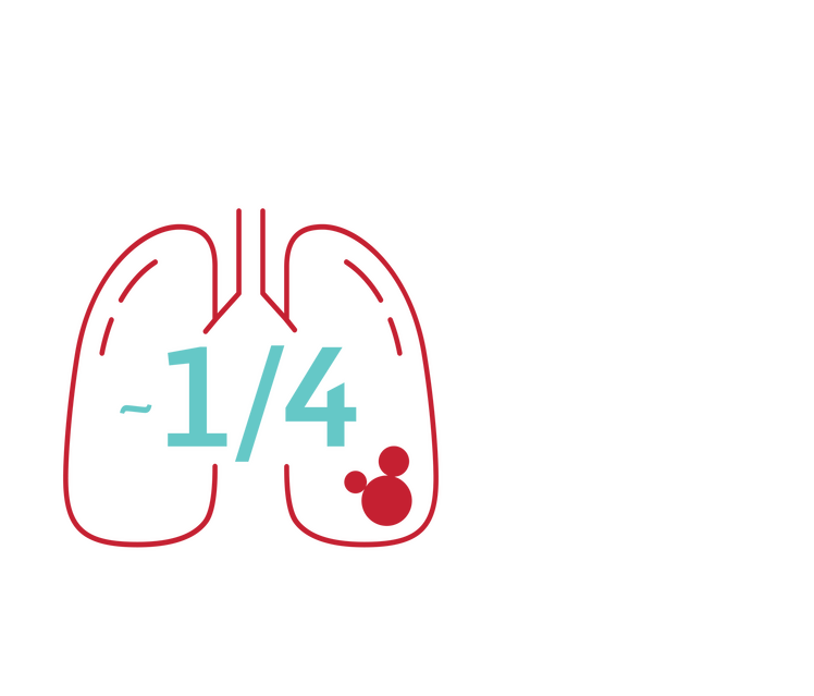 HRI Covid Infographic CMYK 05 1 in 4 pulmonary embolism white